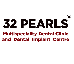 Best Dental Implant Cost in India